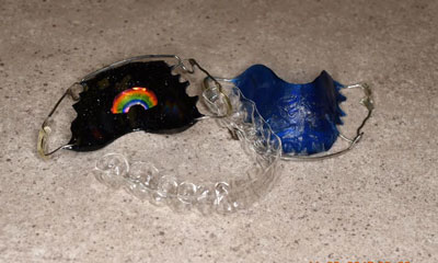 retainer-pic2